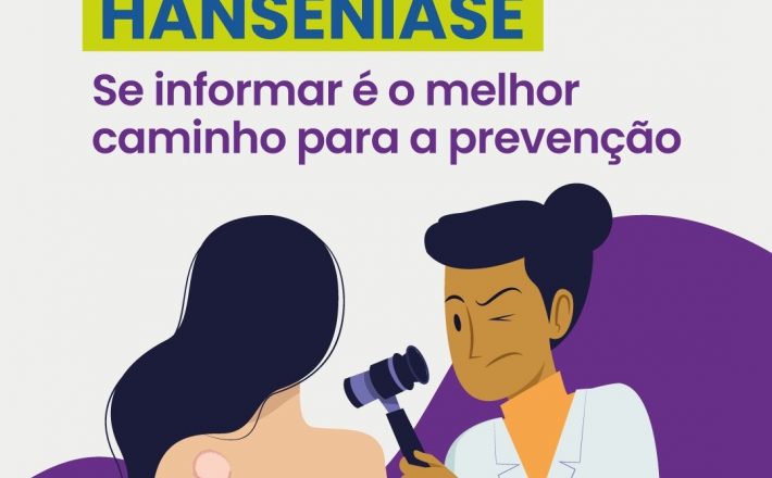 Governo de Minas reforça o alerta e a conscientização da sociedade no combate à hanseníase