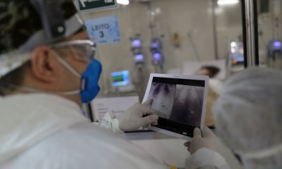 Associações médicas lançam protocolo para triagem de pacientes de UTI