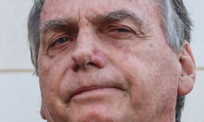 Bolsonaro apresenta piora clínica e vai passar por novos exames