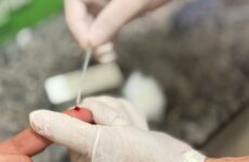Dia de Combate às Hepatites Virais alerta para riscos e reforça serviços de prevenção e testagem em Araxá