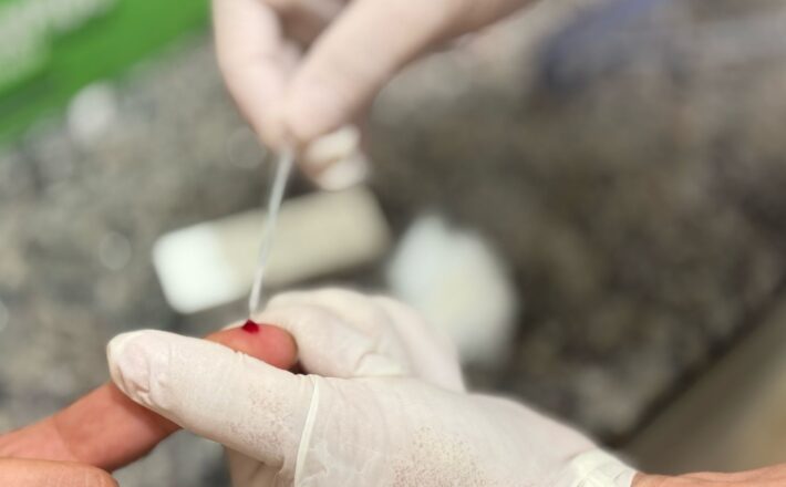Dia de Combate às Hepatites Virais alerta para riscos e reforça serviços de prevenção e testagem em Araxá