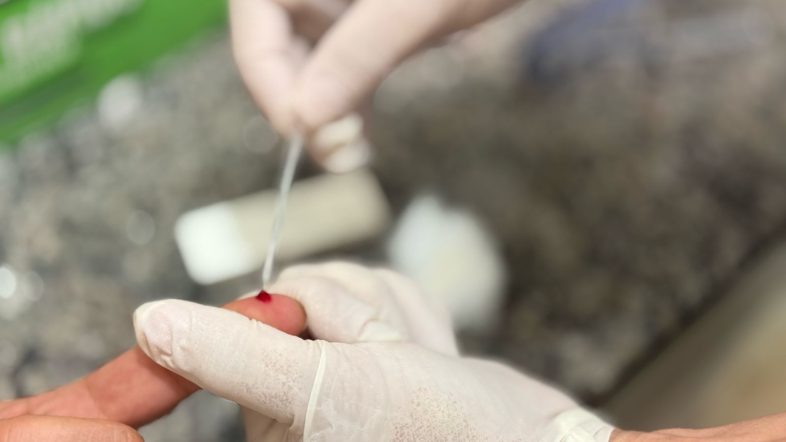 Dia de Combate às Hepatites Virais alerta para riscos e reforça serviços de prevenção e testagem em Araxá