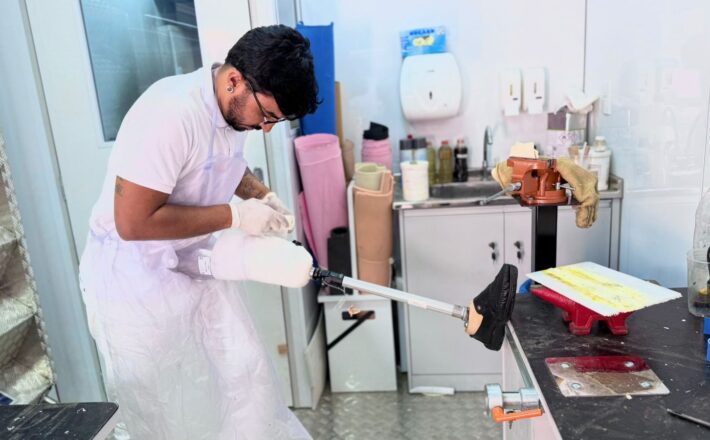 Oficina Ortopédica atende 160 pacientes com próteses, órteses e calçados em parceria entre Apae e Prefeitura