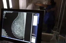 Ministério da Saúde passa a recomendar mamografia a partir dos 40 anos