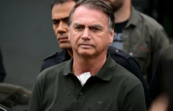 Saúde do ex-presidente Jair Bolsonaro preocupa, mas médicos confirmam câncer de pele em estágio inicial