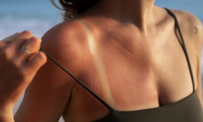 Movimento anti protetor solar: dermatologista destaca os perigos para a saúde da pele