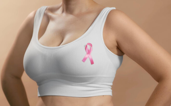 Outubro Rosa: Unimed Araxá doa 60 mamografias e amplia acesso a exames