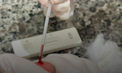 Casos de HIV e sífilis caem em Araxá em 2025; hepatite C registra aumento