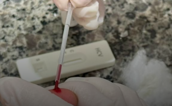 Casos de HIV e sífilis caem em Araxá em 2025; hepatite C registra aumento