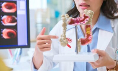 Câncer colorretal: informação e prevenção são aliados no diagnóstico precoce