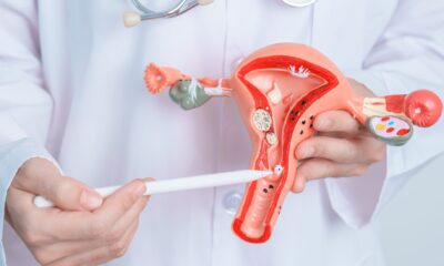 Dor intensa na menstruação pode ser sinal de endometriose, alerta especialista do MPHU